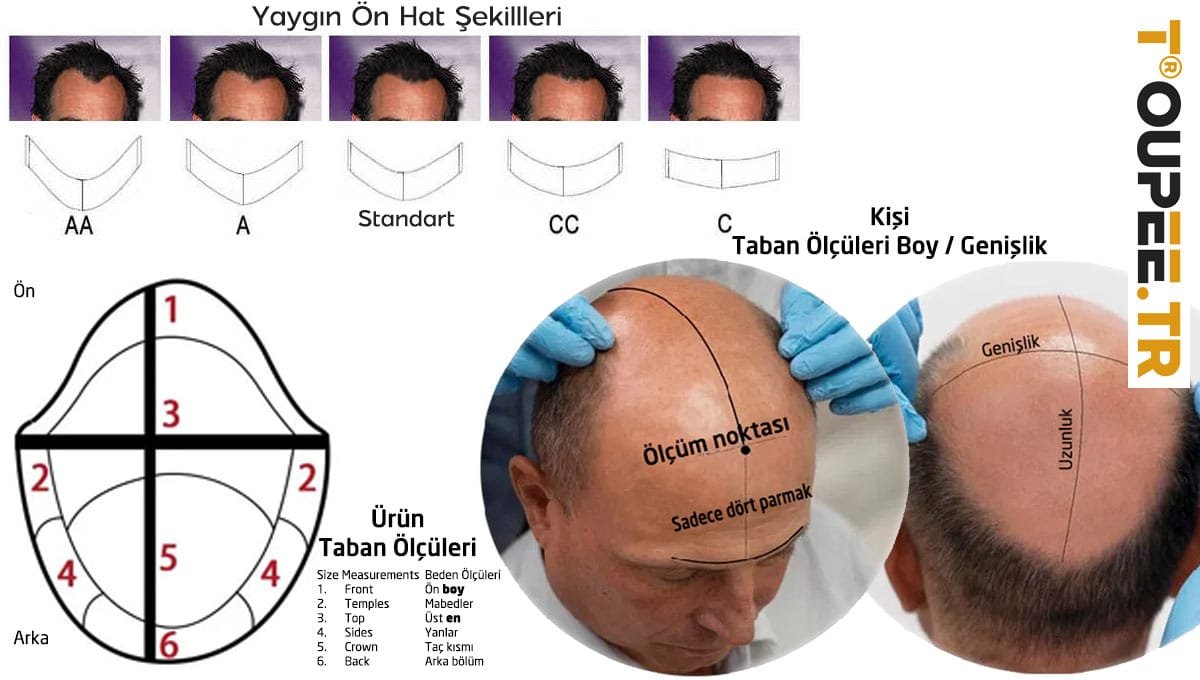 Erkek Protez Saç Tabanı Kesim Şekli