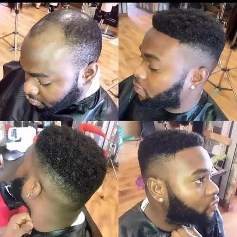 TOUPEE.TR Afro Fransız Dantel Protez Saç