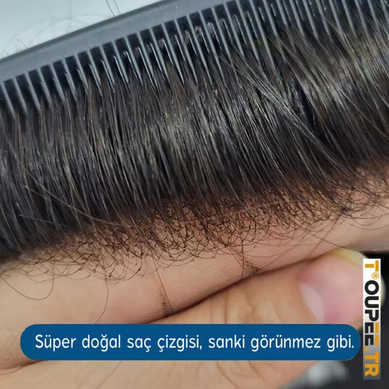 Fransız Dantel TOUPEE.TR Protez Saç